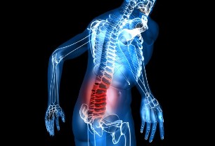 čo je osteochondróza bedrovej chrbtice