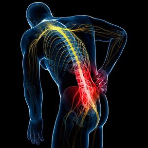 príčiny bolesti chrbta