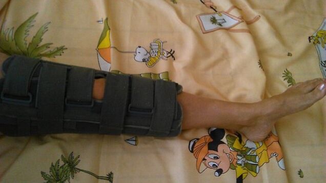 imobilizácia kolenného kĺbu pre bolesť